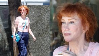 64-letnia Kathy Griffin maszeruje ulicą i prezentuje lico po trzecim liftingu