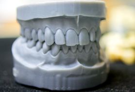 Ząb z frezarki 3D. Na czym polega stomatologia cyfrowa?
