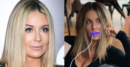 Zblazowana Małgorzata Rozenek pozuje z aparatem do wybielania w buzi. Internauci: "Wybiela pani PORCELANOWE ZĘBY?"