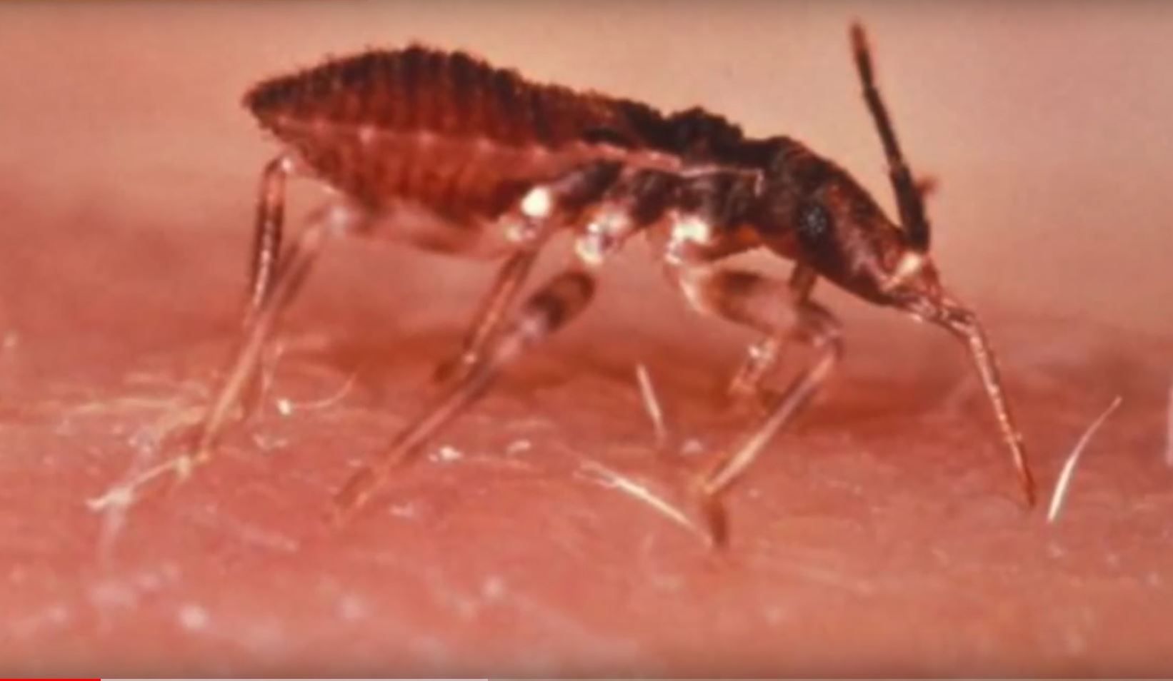 Naukowcy ostrzegają przed śmiertelną chorobą przenoszoną przez "całujące robaki"