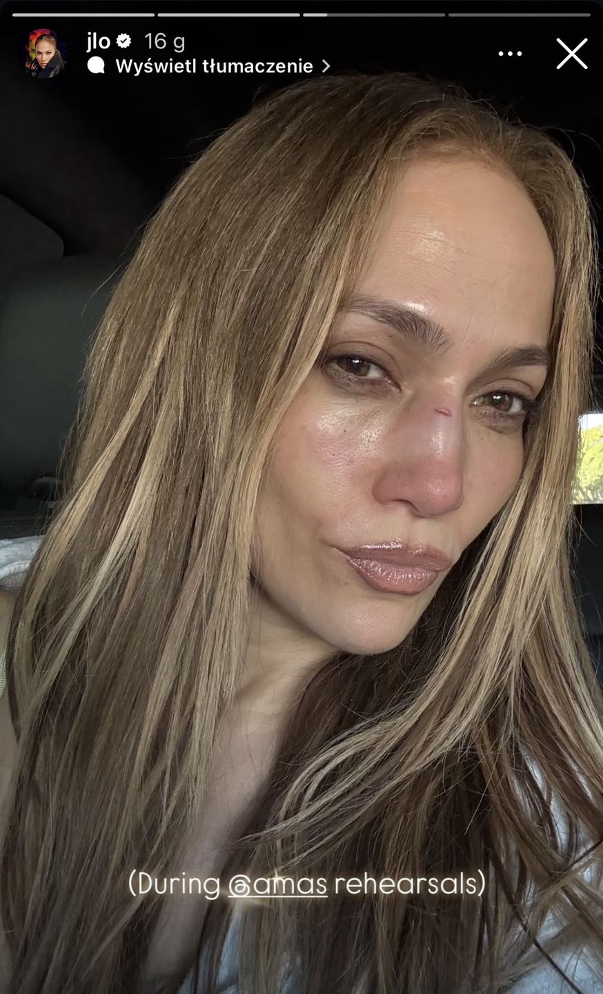 Jennifer Lopez nabawiła się kontuzji