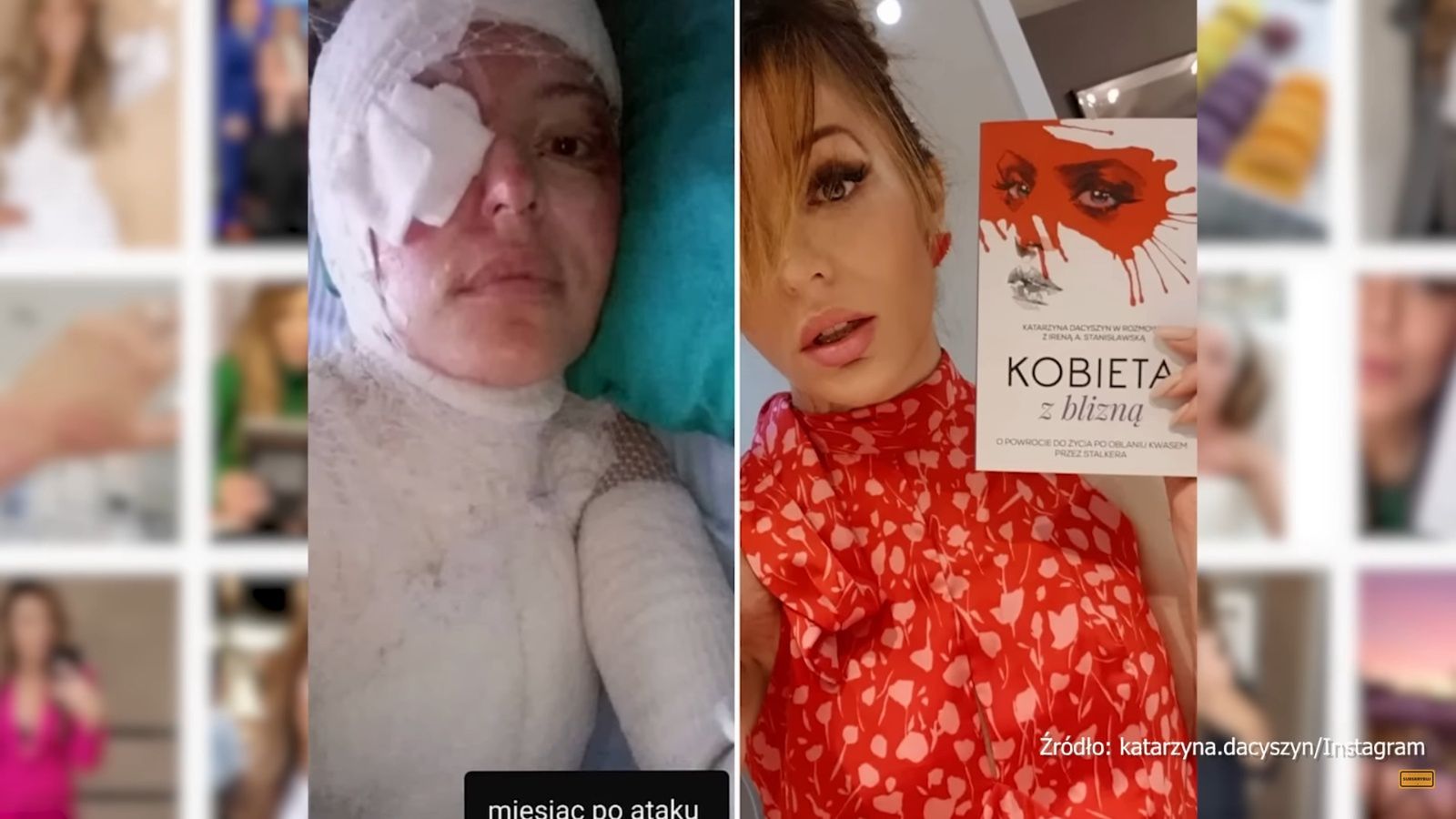 Katarzyna Dacyszyn opowiada o ataku stalkera