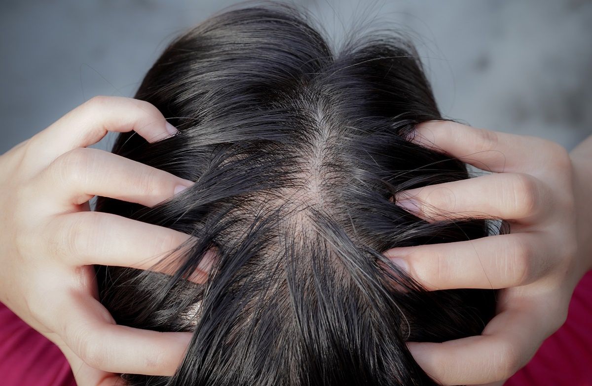 Rosemary rinse: A natural remedy to combat hair loss