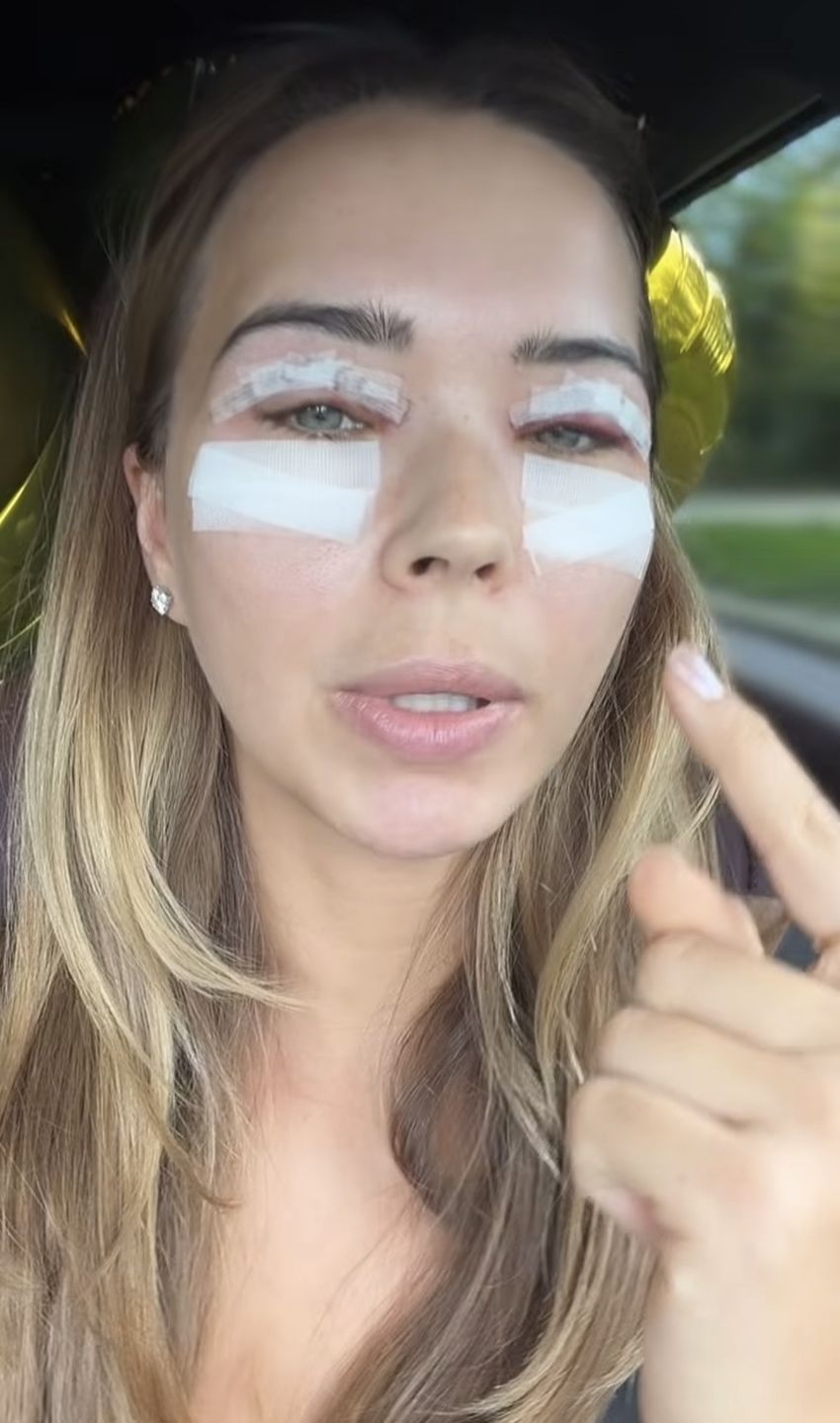 Sandra Kubicka po operacji
