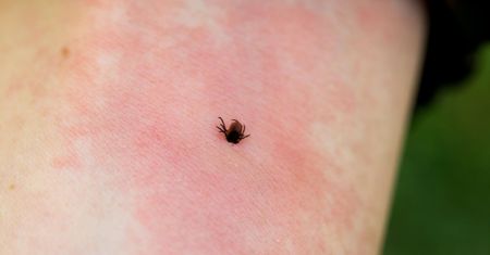 Panika wokół kleszczy. Obalamy najpopularniejsze mity