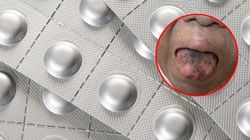 Język 60-latki stał się czarny i włochaty. Taki był powód