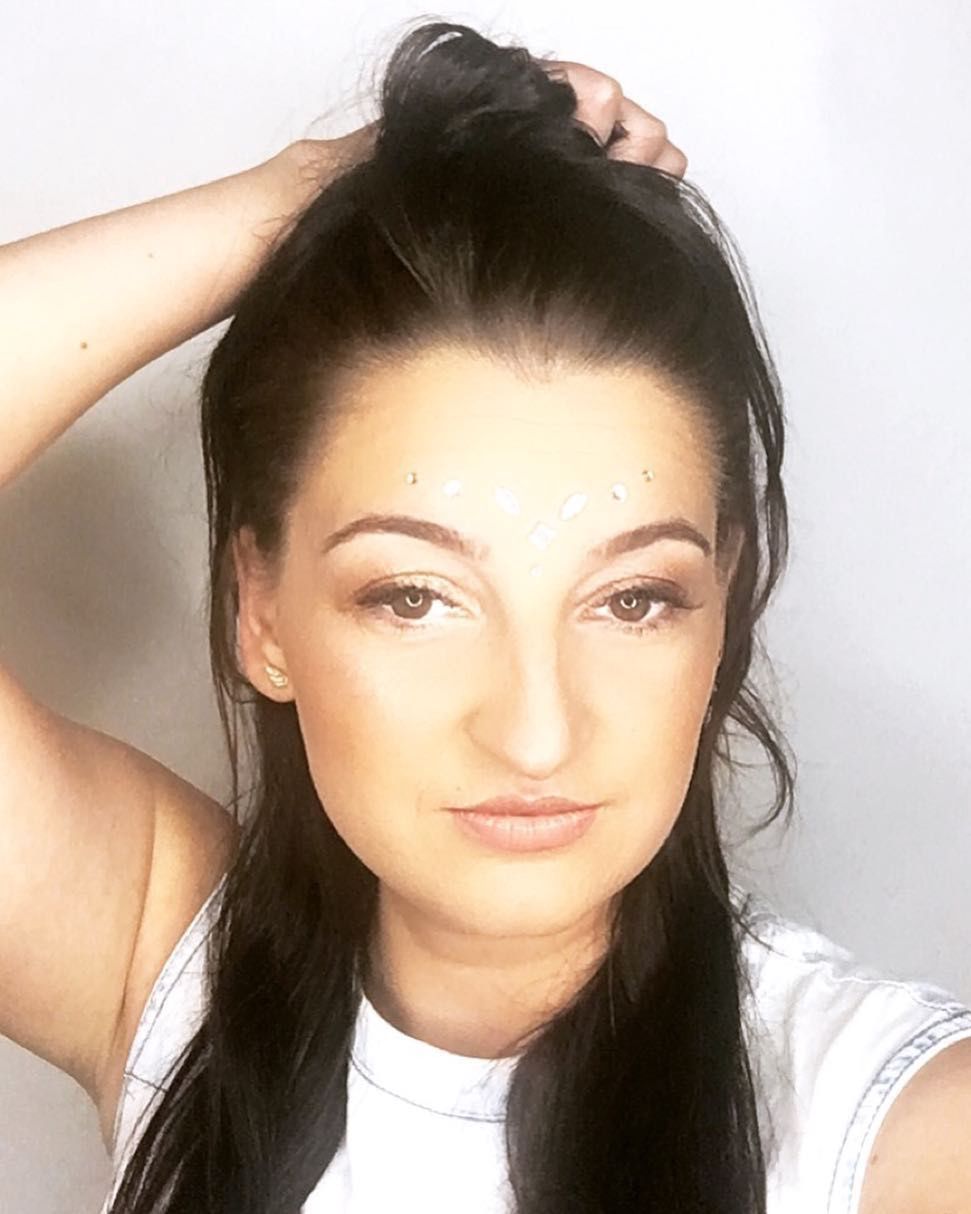 Aleksandra Pisarek przed operacją nosa