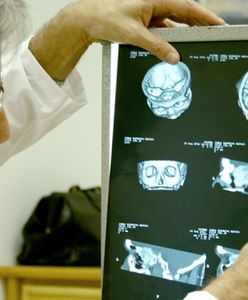 Lewe zwolnienia – konieczność czy kaprys?