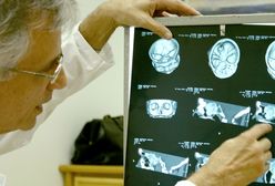 Lewe zwolnienia – konieczność czy kaprys?