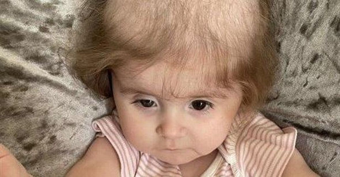 Dziewczynka wyrywała sobie włosy z głowy