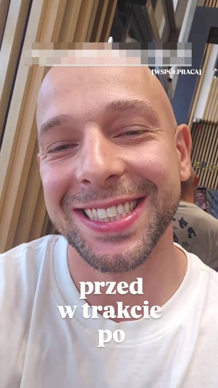 Maciej Pela poleciał do Turcji po nowy uśmiech
