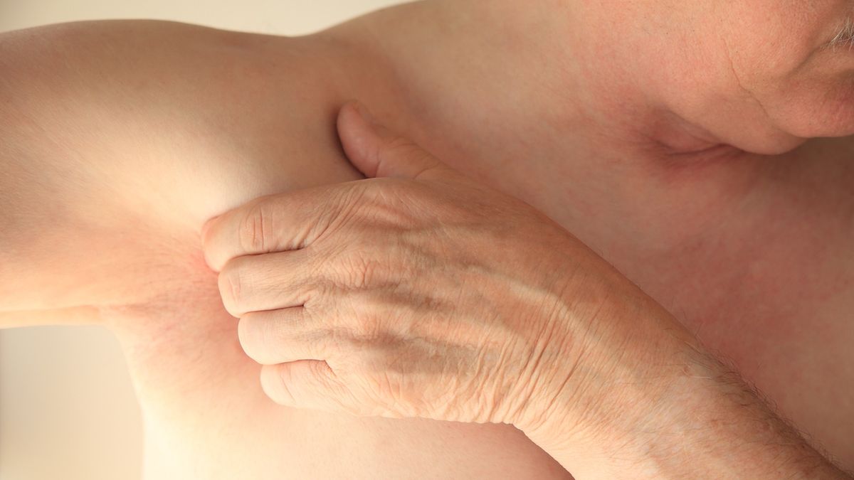 Swędzenie pod pachami może być objawem raka