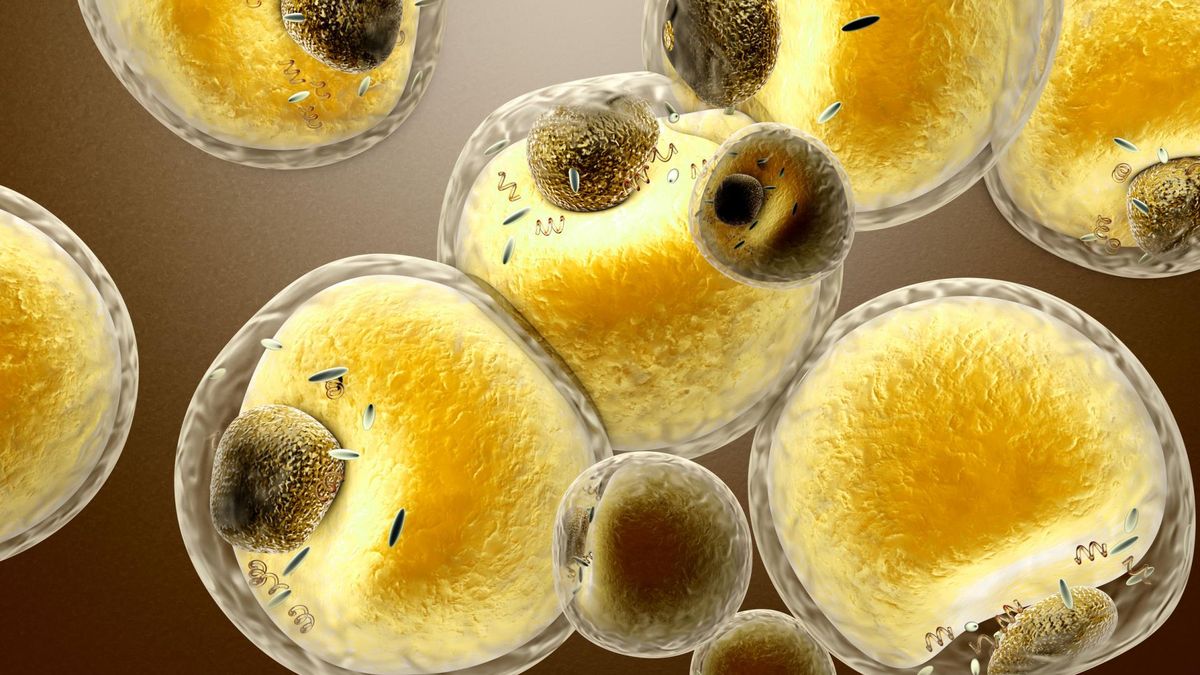 Cholesterol sprzyja miażdżycy