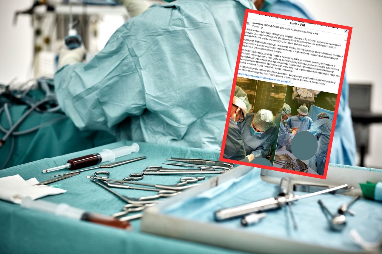 Usunęli pacjentowi guza ważącego 20 kg. "To nasza codzienna praca"
