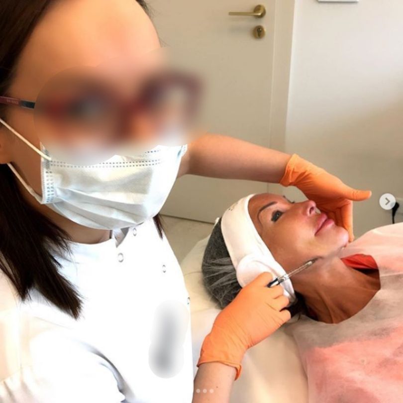 Ewa Minge pochwaliła się zabiegiem medycyny estetycznej