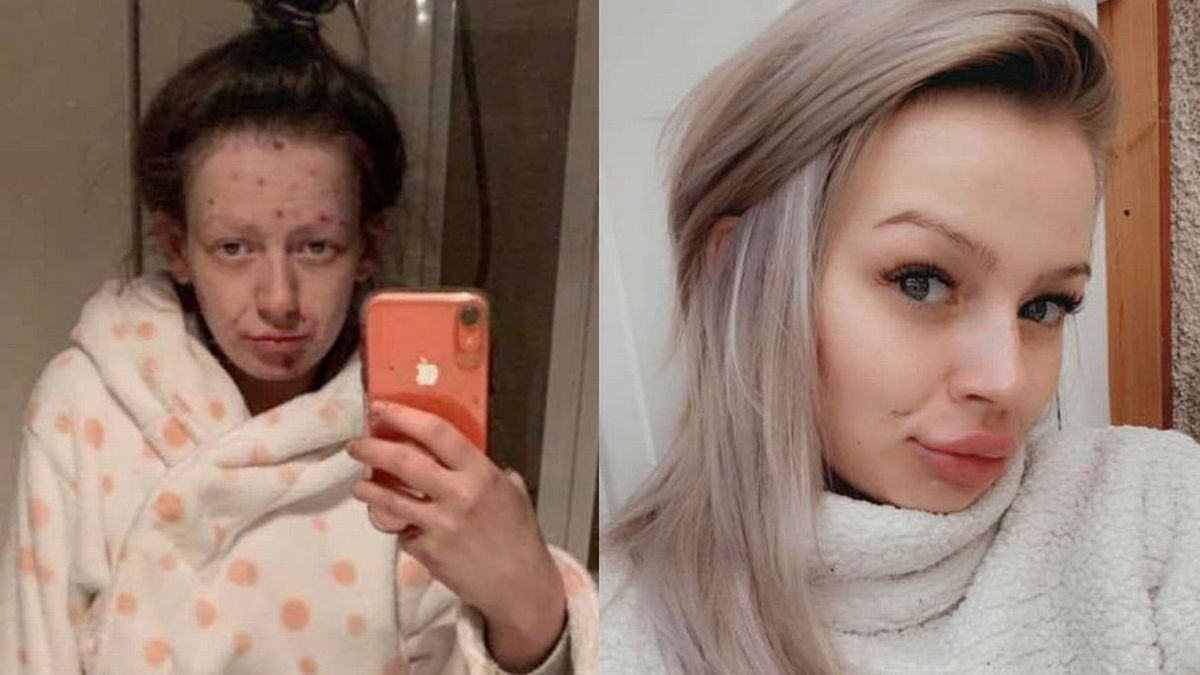 metamorfoza narkomanki