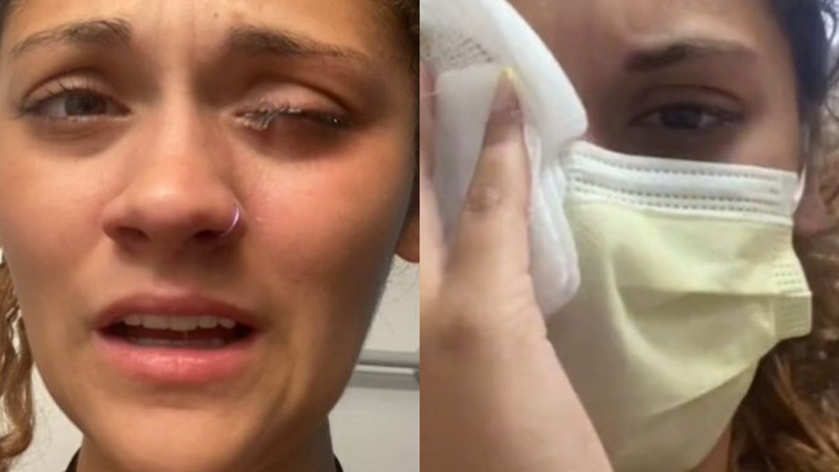 Zakropiła tym oczy. Wylądowała w szpitalu. 