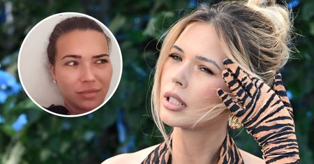 Sandra Kubicka narzeka na bliznę po cesarce. "Jestem chodzącym barometrem"
