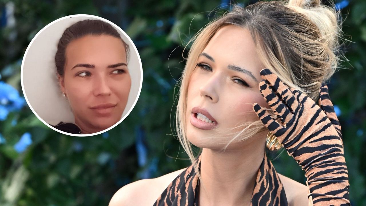 Sandra Kubicka narzeka na bliznę po cesarce. "Jestem chodzącym barometrem"