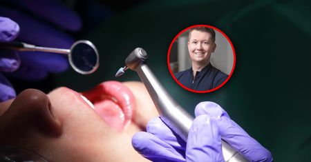 Kwas niszczy zęby młodych. "Dzisiejsi 30-latkowie stracą szybciej zęby"