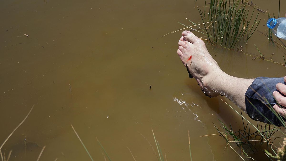 Na pijawki można już trafić nad jeziorem