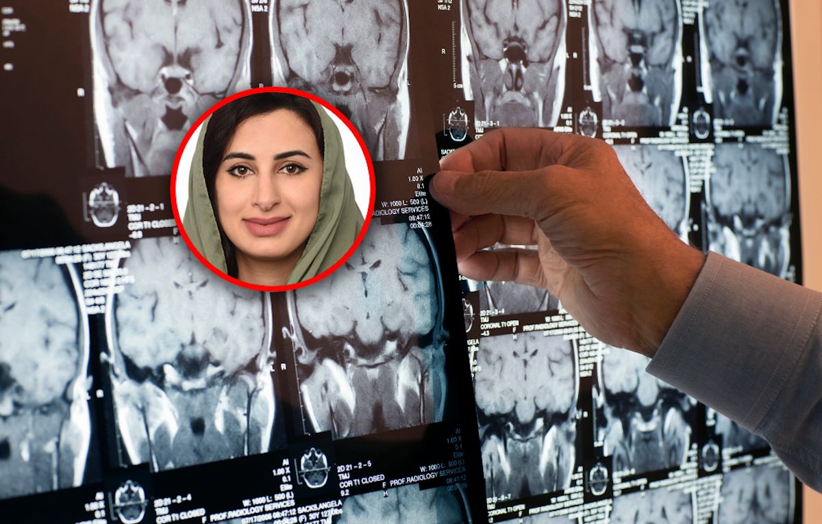 Poprawia pamięć i opóźnia starzenie mózgu. Nie dopuść do niedoboru