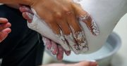 W zakopiańskim szpitalu mają ręce pełne roboty. "Zużyliśmy już kilkaset kilogramów gipsu"