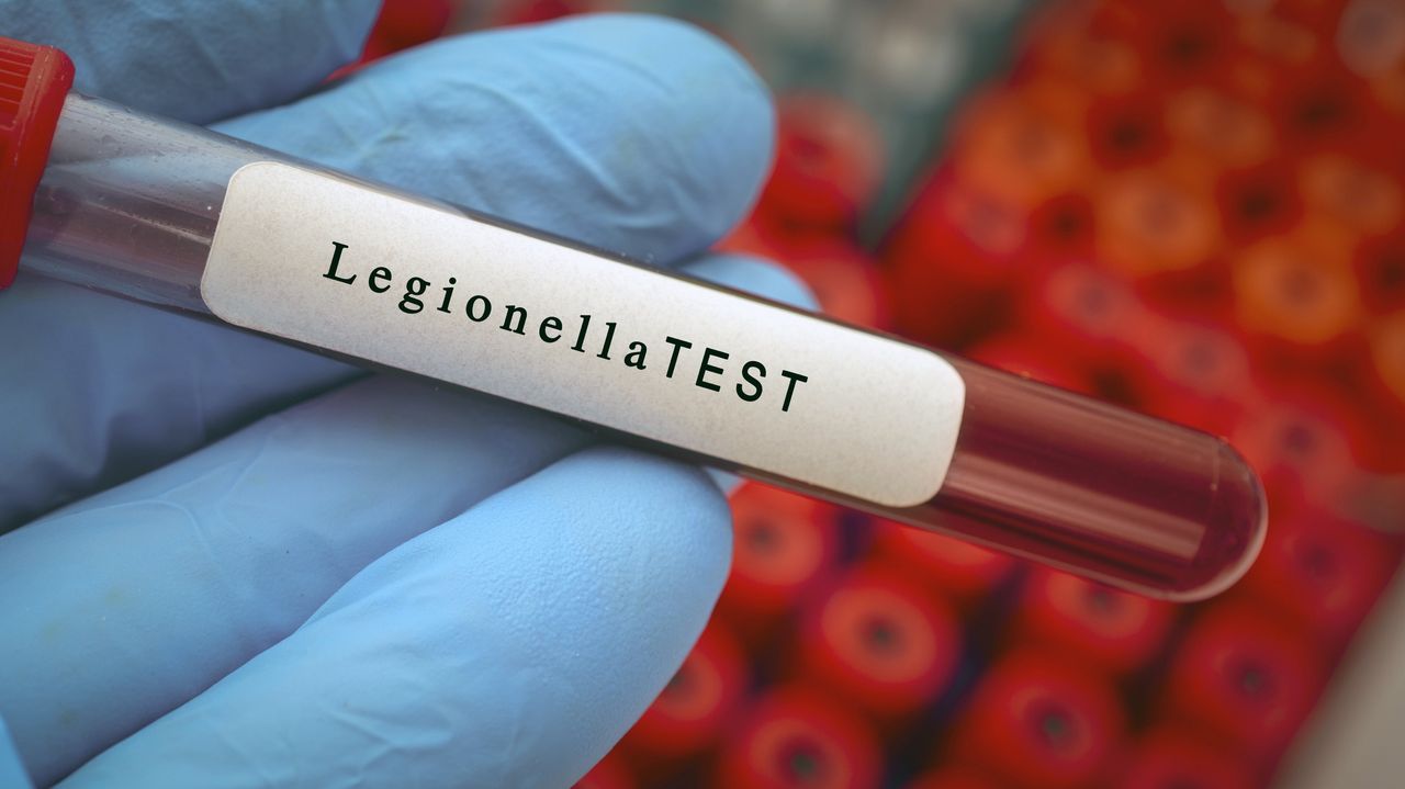 Legionella w Polsce. Władze nie wdrożyły unijnej dyrektywy