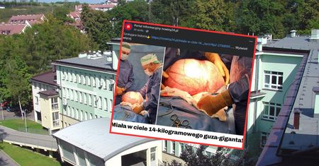 Miał 14 kilogramów. Lekarze usunęli guza giganta