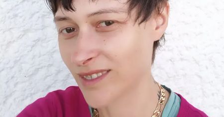 Karina z "Chłopaków do wzięcia" jest nie do poznania. Tak wygląda po zabiegu