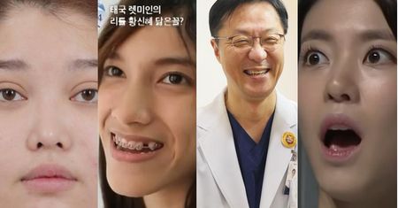 Koreańczycy chwalą się efektami operacji plastycznych... w programie telewizyjnym. Są nie do poznania! (ZDJĘCIA)