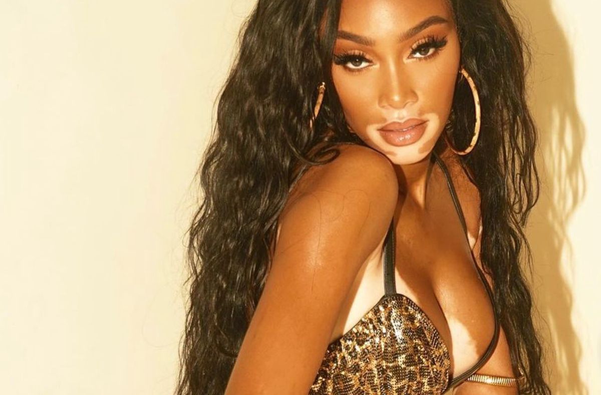 Winnie Harlow znowu zachwyciła. Co za ruchy!