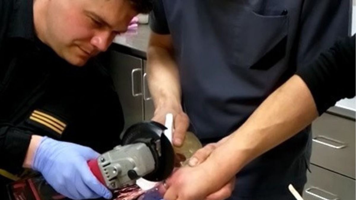 strażacy uratowali mu palec/ Kadr z nagrania