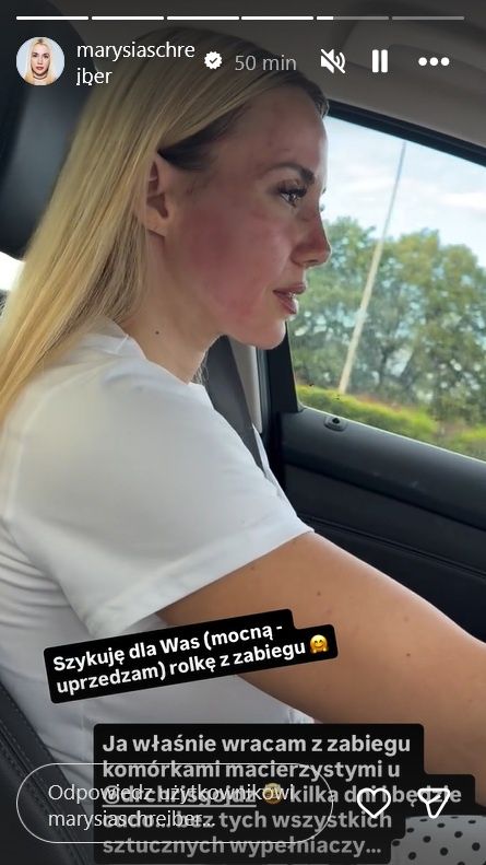 Marianna Schreiber pokazała się po zabiegu kosmetycznym