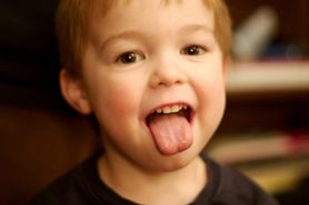 Grzybica języka - rodzaje, przyczyny, objawy, leczenie