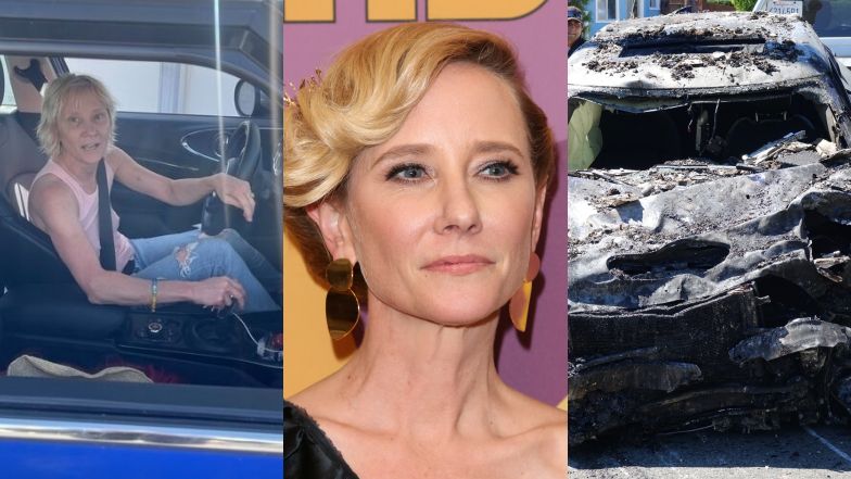 Anne Heche jest w śpiączce po wypadku. Jej stan jest KRYTYCZNY: "NIE PRZEŻYJE"