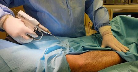 Bielsko-Biała. Szpital ma nowy sprzęt, bezpieczniejsze operacje