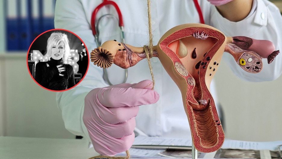 Kora przez wiele lat zażywała leki przeciwbólowe. Mimo że była pod opieką lekarzy, to nie była badana pod kątem nowotworu.