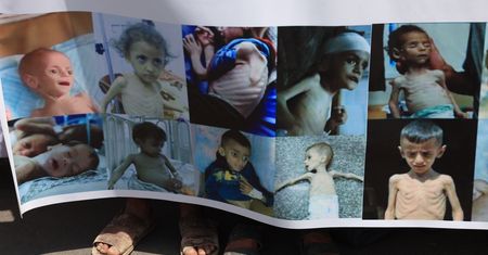 Kryzys humanitarny w Strefie Gazy. Lekarze mówią, co dzieje się na miejscu