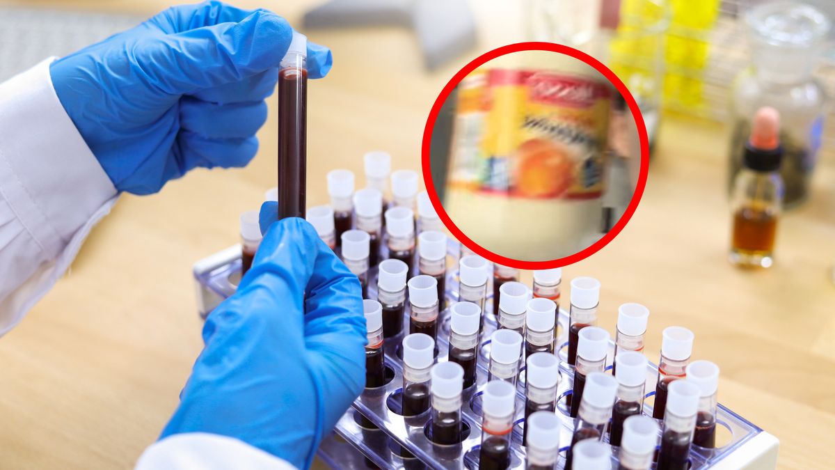 Zdziwiła się, gdy po oddaniu krwi dostała majonez.