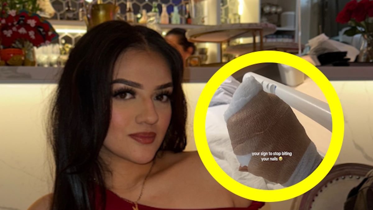 Obgryzała paznokcie. Pokazała, co stało się z jej ręką