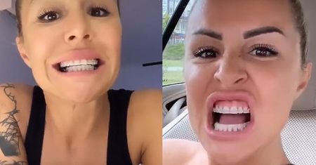 Blanka Lipińska przeszła zabieg WYDŁUŻANIA ZĘBÓW: "Mam większe zęby, SĄ SUPER!"