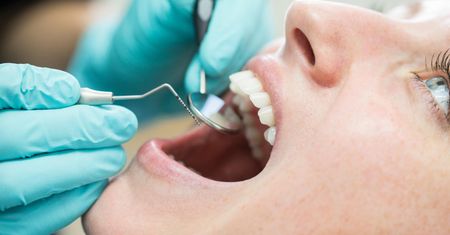 NFZ zaczął je refundować. Polacy zaskoczeni, zapisują się do dentysty