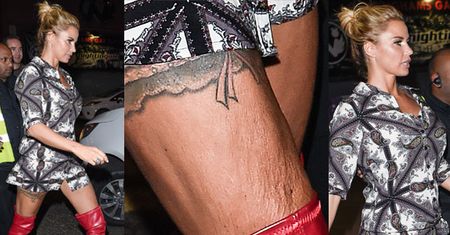 Tak wygląda z bliska skóra Katie Price... (ZDJĘCIA)
