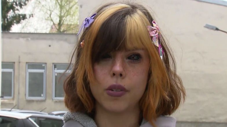 "Fanka Popka" TRACI WZROK i pozywa mężczyznę, który wytatuował jej gałki oczne