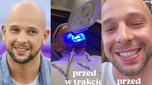 Maciej Pela zafundował sobie TURECKIE ZĄBKI: "Jadę zrobić coś, co obniża moją pewność siebie". Efekt podniesie jego samoocenę? (ZDJĘCIA)