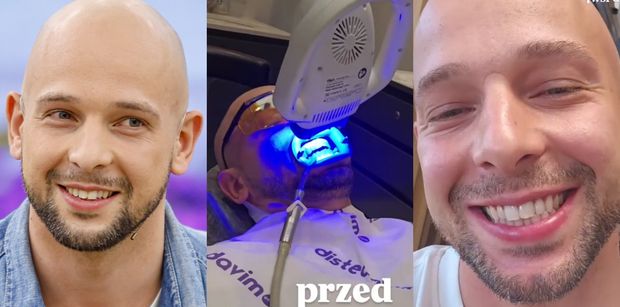 Maciej Pela zafundował sobie TURECKIE ZĄBKI: "Jadę zrobić coś, co obniża moją pewność siebie". Efekt podniesie jego samoocenę? (ZDJĘCIA)