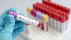 Terapia bezinterferonowa szansą dla chorych na WZW typu C. Niestety, nie dla wszystkich