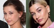 Hailey Bieber zaprzecza, że poddała się operacjom plastycznym: "Nigdy NIE TKNĘŁAM mojej twarzy!"