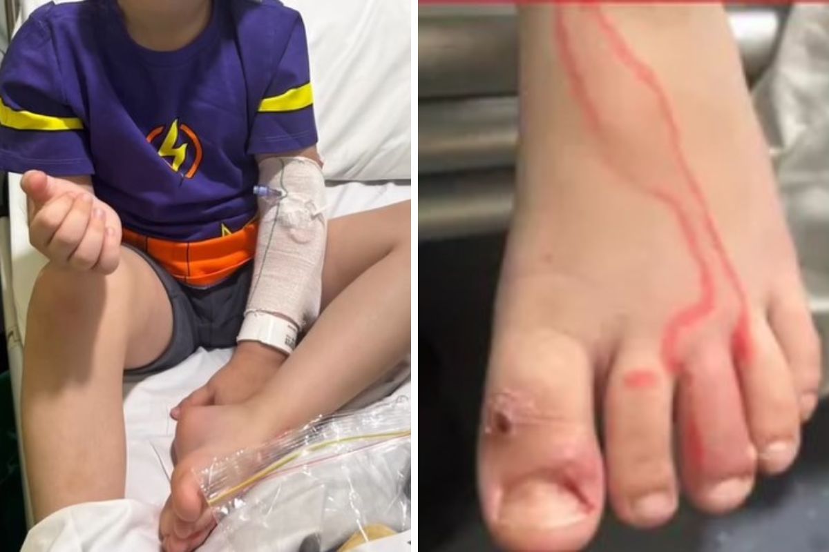 Chłopiec cierpiał na zapalenie naczyń limfatycznych